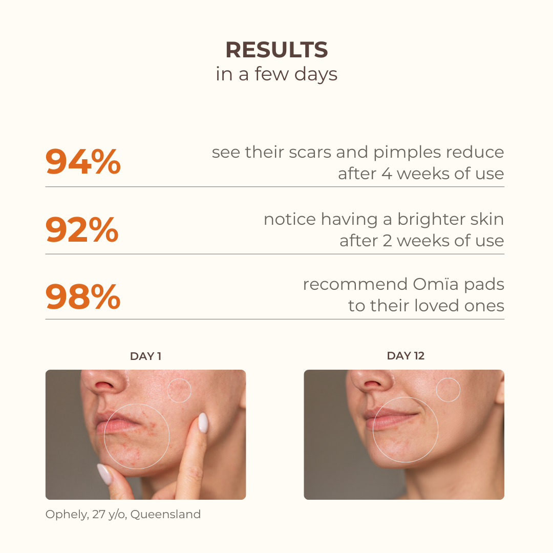 Anti-Blemishes Turmeric Pads