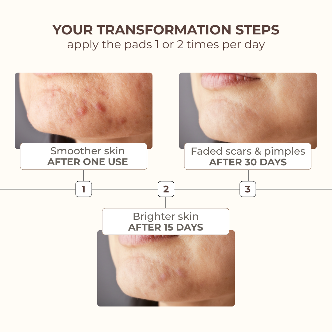Anti-Blemishes Turmeric Pads