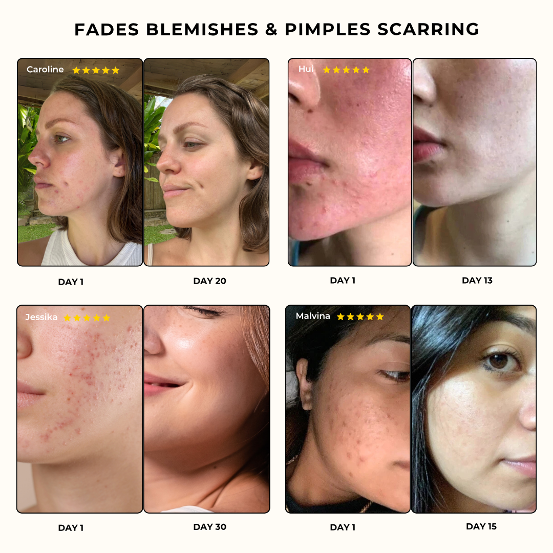 Turmeric & Kojic Acid Cleansing Pads