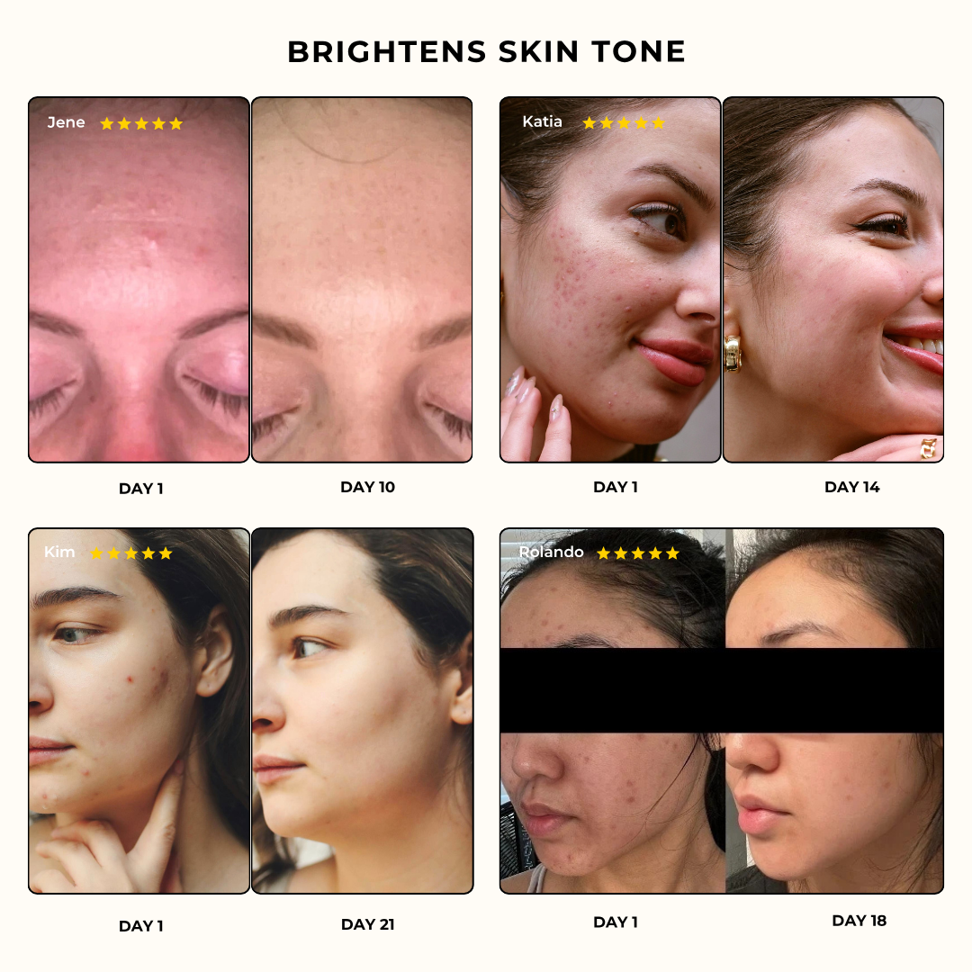 Turmeric & Kojic Acid Cleansing Pads