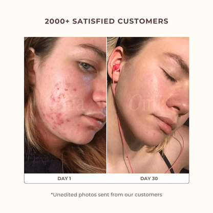 Anti-Blemish Turmeric Pads