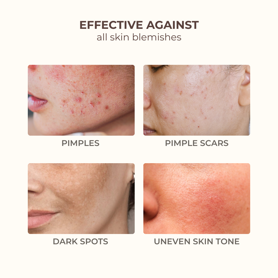 Anti-Blemishes Turmeric Pads